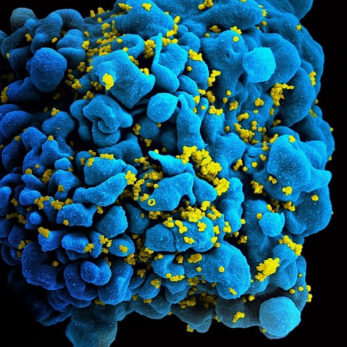 HIV Vaccine Candidate Does Not Sufficiently Protect Women Against HIV Infection