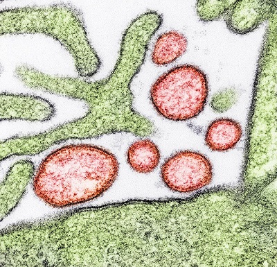 NIH launches clinical trial of mRNA Nipah virus vaccine
