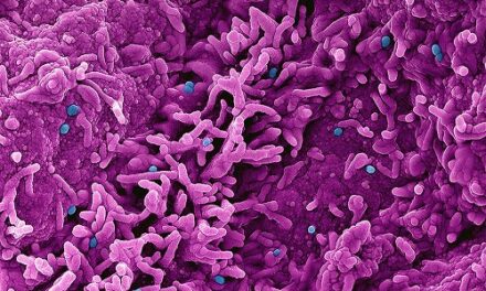 NIH scientists develop mouse model to study mpox virulence