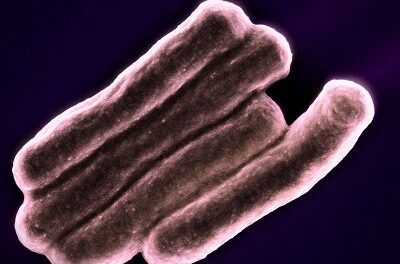 Investigational Three-Month TB Regimen Is Safe but Ineffective, NIH Study Finds