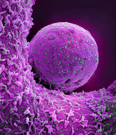 COVID-19 vaccination and boosting during pregnancy benefits pregnant people and newborns