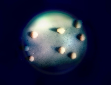 NIH study examines connections between drinking water quality and increased lung infections in people with cystic fibrosis