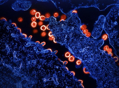 NIH-developed HIV antibodies protect animals in proof-of-concept study