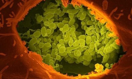 Researchers create safer form of Coxiella burnetii for scientific use