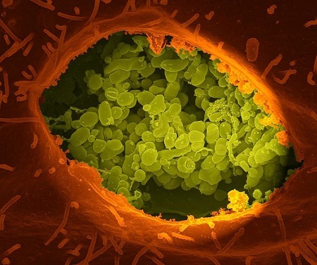 Researchers create safer form of Coxiella burnetii for scientific use