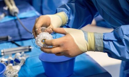 Tampa General Hospital Is the First and Only in the Southeast to Complete Transcatheter Mitral Valve Replacement (TMVR) with AltaValve Technology