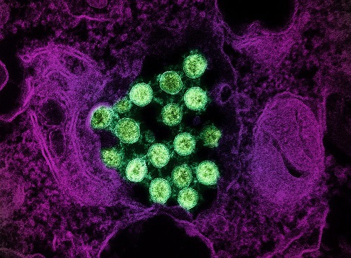 COVID-19 vaccination and boosting during pregnancy protects infants for six months