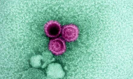 NIH scientists find weak points on Epstein-Barr virus