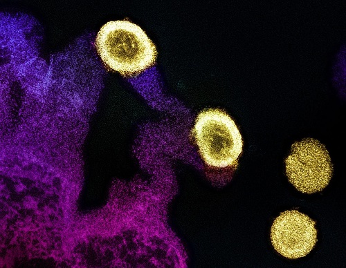 Semaglutide reduces severity of common liver disease in people with HIV