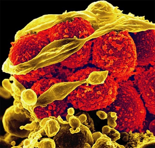 Doctors underutilize next-gen antibiotics to fight resistant infections in U.S. hospitals