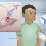 Experimental NIH malaria monoclonal antibody protective in Malian children