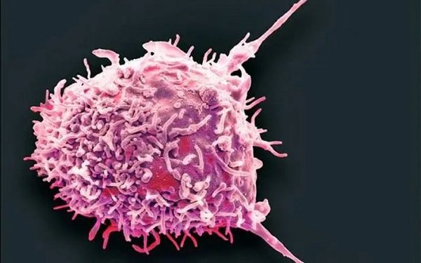 Mayo Clinic scientists pioneer immunotherapy technique for autoimmune diseases