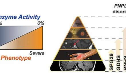 Scientists unravel genetic basis for neurodegenerative disorders that affect vision