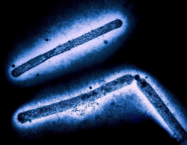 NIH releases H5N1 influenza research agenda