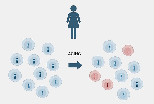 Inherited genetic factors may predict the pattern of X chromosome loss in older women