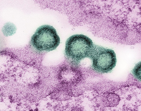Long-acting injectable cabotegravir for HIV prevention is safe in pregnancy