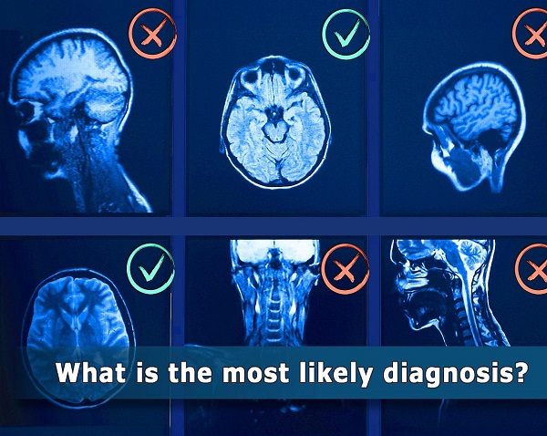NIH findings shed light on risks and benefits of integrating AI into medical decision-making