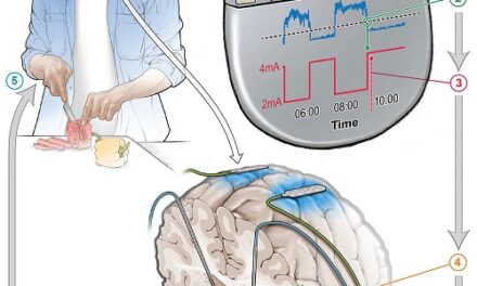 Self-adjusting brain pacemaker may help reduce Parkinson’s disease symptoms