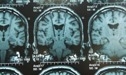 Expert alert: Surgical approaches being studied to restore function after stroke