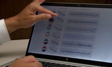 AI boosts the power of EEGs, enabling neurologists to quickly, precisely pinpoint signs of dementia