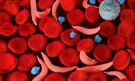 Genetic carriers for sickle cell disease have higher risks of blood clots across diverse ancestries