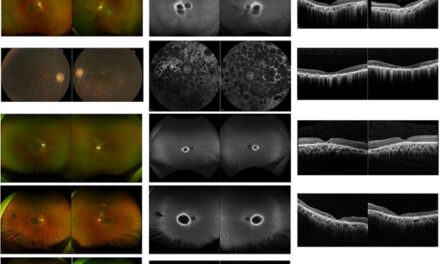Scientists discover gene responsible for rare, inherited eye disease