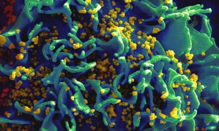 NIH trial of rectal microbicide for HIV prevention begins in the United States