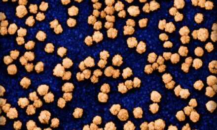 First wave of COVID-19 increased risk of heart attack, stroke up to three years later