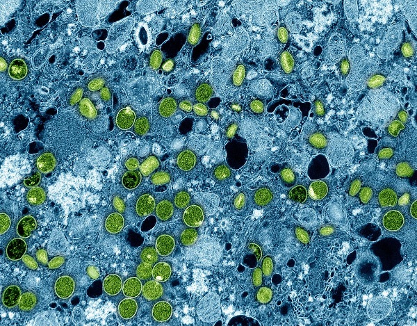 Mpox vaccine is safe and generates a robust antibody response in adolescents