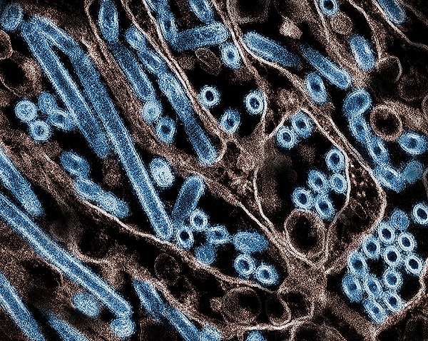 Bovine H5N1 influenza from infected worker transmissible and lethal in animal models