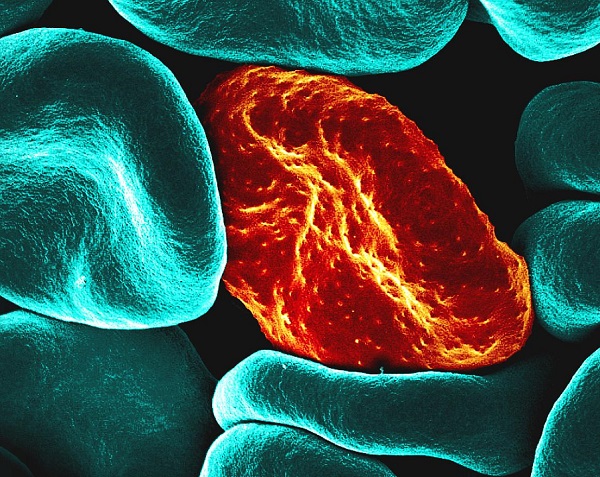 NIH researchers discover novel class of anti-malaria antibodies
