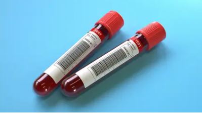 Research Shows Blood Test May Provide Personalized Dietary Therapy for Patients with Irritable Bowel Syndrome