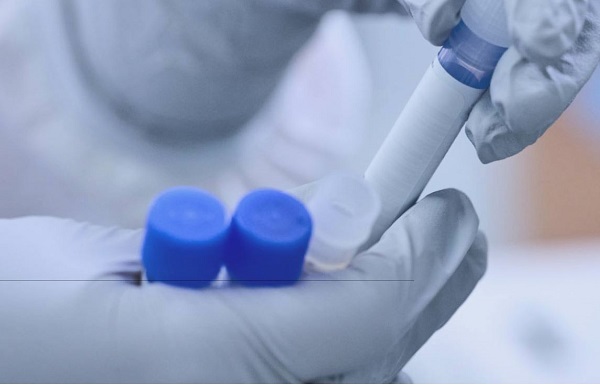 Mayo Clinic Laboratories and Amprion announce collaboration to advance neurodegenerative disease diagnostics