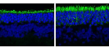 Repurposing a blood pressure drug may prevent vision loss in inherited blinding diseases
