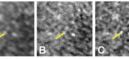 NIH researchers supercharge ordinary clinical device to get a better look at the back of the eye