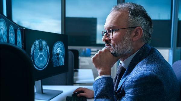 Mayo Clinic’s AI tool identifies 9 dementia types, including Alzheimer’s, with one scan