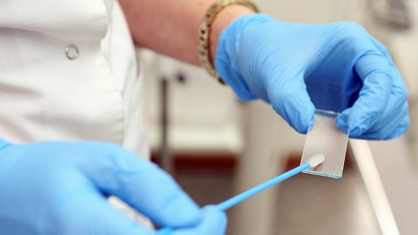 Mailed self-collection HPV tests boost cervical cancer screening rates
