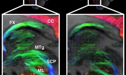 Scientists Develop High-Performance MRI Scanner in Effort to Define Microscopic Brain Structures