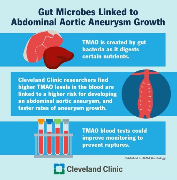 New Cleveland Clinic Research Identifies Link Between Gut Microbes and an Elevated Risk for Abdominal Aortic Aneurysms