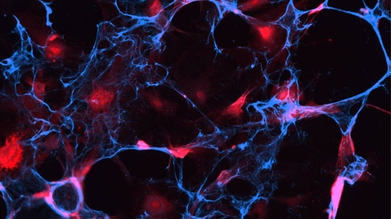 A new tool to find hidden 'zombie cells' - Florida Hospital News