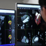 NCH Becomes First U.S. Hospital to Use AI That Detects Hidden Heart Attack Risk a Decade in Advance