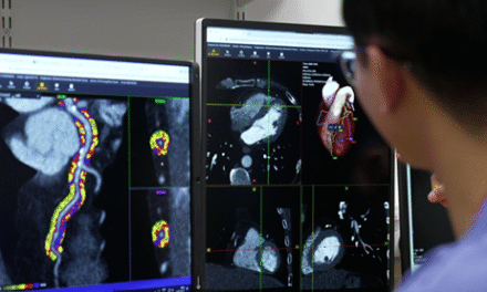 NCH Becomes First U.S. Hospital to Use AI That Detects Hidden Heart Attack Risk a Decade in Advance