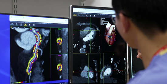 NCH Becomes First U.S. Hospital to Use AI That Detects Hidden Heart Attack Risk a Decade in Advance