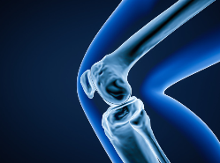 Significant Gift Funds Development of the HSS Digital Twin Platform for Optimizing Orthopedic Care