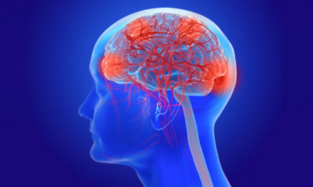 A ‘major steppingstone’ against Alzheimer’s