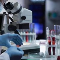 Study measuring changes in protein structure establishes new class of Alzheimer’s biomarkers