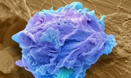 Novel CAR T cell therapy developed by UT MD Anderson researchers moves into clinical studies