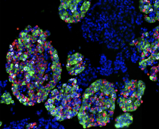 NIH-funded study maps human pancreatic islet cells, offering new clues to diabetes risk