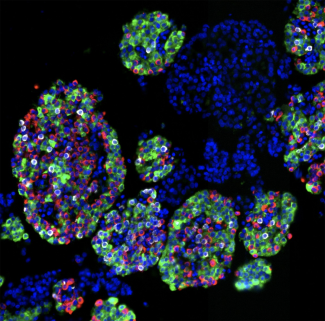 NIH-funded study maps human pancreatic islet cells, offering new clues to diabetes risk