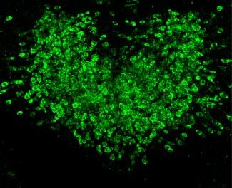 NIH researchers identify avenue for enhanced GLP-1-induced weight loss